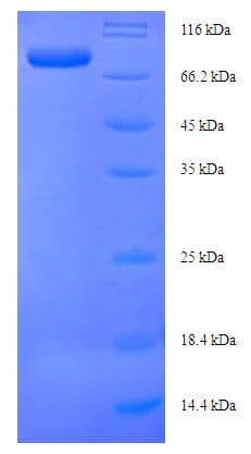 E. coli Glutamate--Cysteine Ligase Protein (Recombinant His-SUMO)