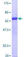 Human ANXA1 / Annexin A1 Protein (Recombinant GST)