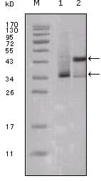 ER Alpha / Estrogen Receptor Antibody (clone 10H12B10)