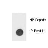 CSF2RB / CD131 Antibody (phospho-Tyr766)
