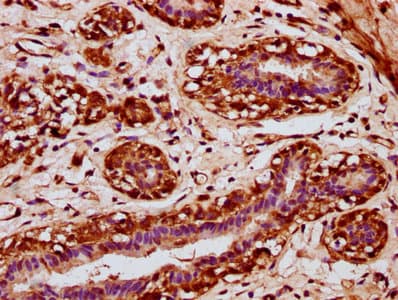 POU3F4 Antibody