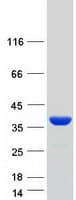 Human NT5C3A Protein (Recombinant Myc-DDK (Flag))