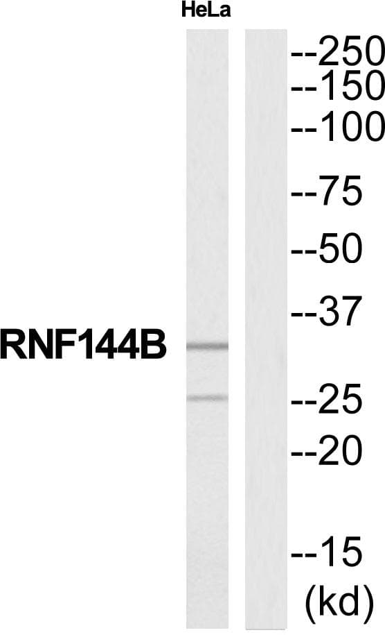Polyclonal Rabbit anti-Human RNF144B Antibody (WB)