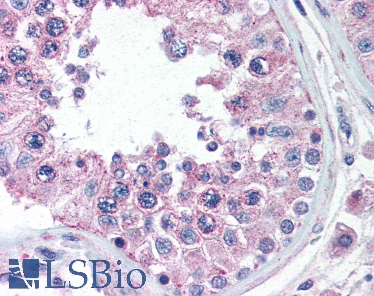 IHC-plus™ BRCTD1 / ANKRD32 Antibody