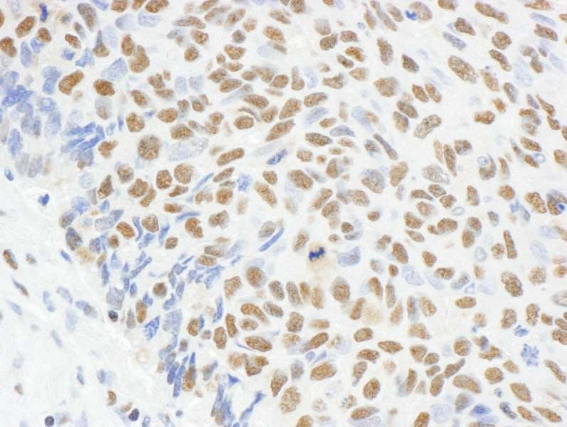 IHC-plus™ MAD2L1 / MAD2 Antibody (aa100-150)