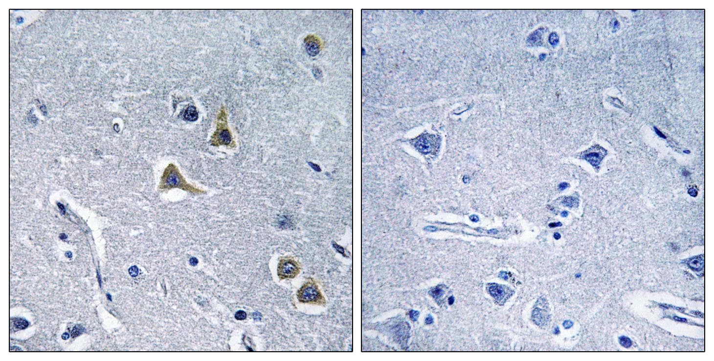 ARRDC2 Antibody