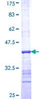 Human RNASEH1 Protein (Recombinant GST, N-terminus)