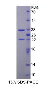 Rat TOPBP1 Protein (Recombinant His-T7, N-terminus)