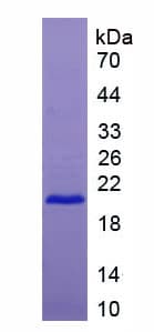 Human CD27 Protein (Recombinant His)