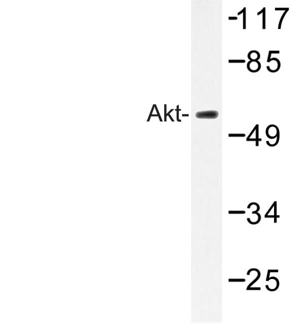 Polyclonal Rabbit anti-Human AKT1 Antibody (Met118, WB)