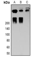 DSP / Desmoplakin Antibody