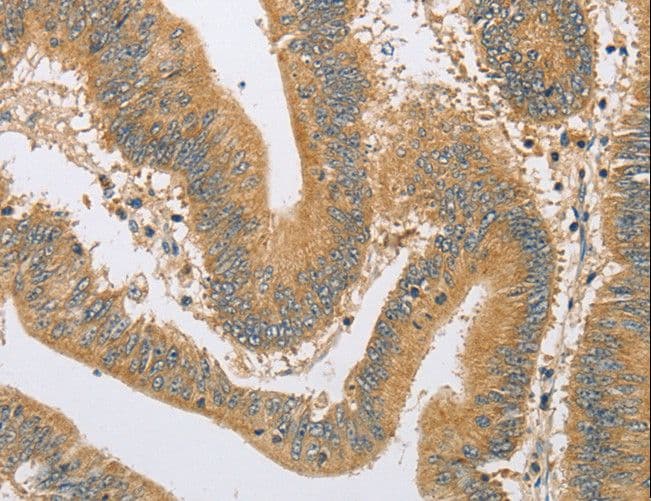 ARHGEF1 Antibody