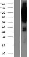 Human PR / Progesterone Receptor Protein (Over-Expression Lysate Myc-DDK (Flag))