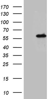 NFKBIE / IKB Epsilon Antibody (clone OTI6H8)