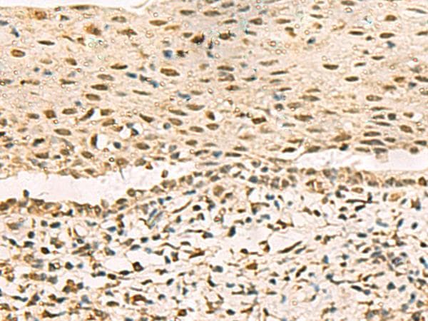 GRWD1 Antibody