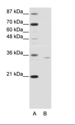 Polyclonal Rabbit anti-Human OTP Antibody (C-Terminus, WB)