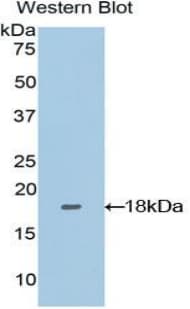 SEMA3A / Semaphorin 3A Antibody (aa31-150)