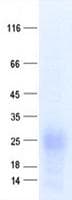 Human TSPAN7 / CD231 Protein (Recombinant DDK,C-terminus)