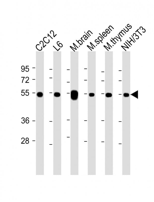 Polyclonal Rabbit anti-Human Tubulin beta-5 chain Antibody (IHC, IF, WB)