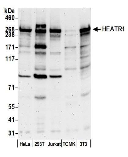 Polyclonal Rabbit anti-Human HEATR1 Antibody (aa1200-1250, WB)