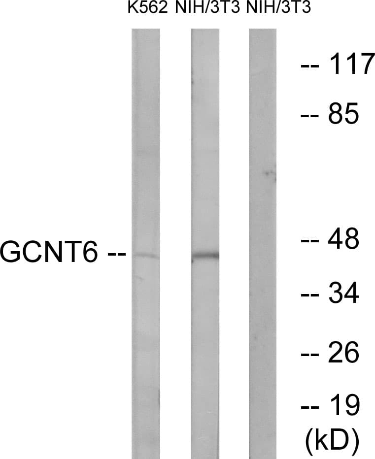 GCNT6 Antibody (aa201-250)