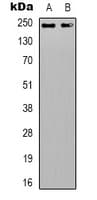 DATF1 / DIDO1 Antibody (N-Terminus)