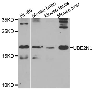 UBE2NL Antibody