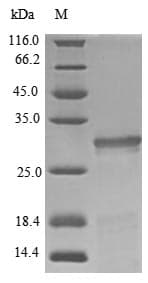 Pig GH / Growth Hormone Protein (Recombinant 10His, N-terminus + Myc, C-terminus)
