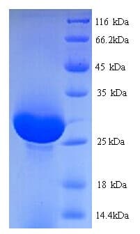 Rat PRSS1 / Trypsin Protein (Recombinant 6His, N-terminus)