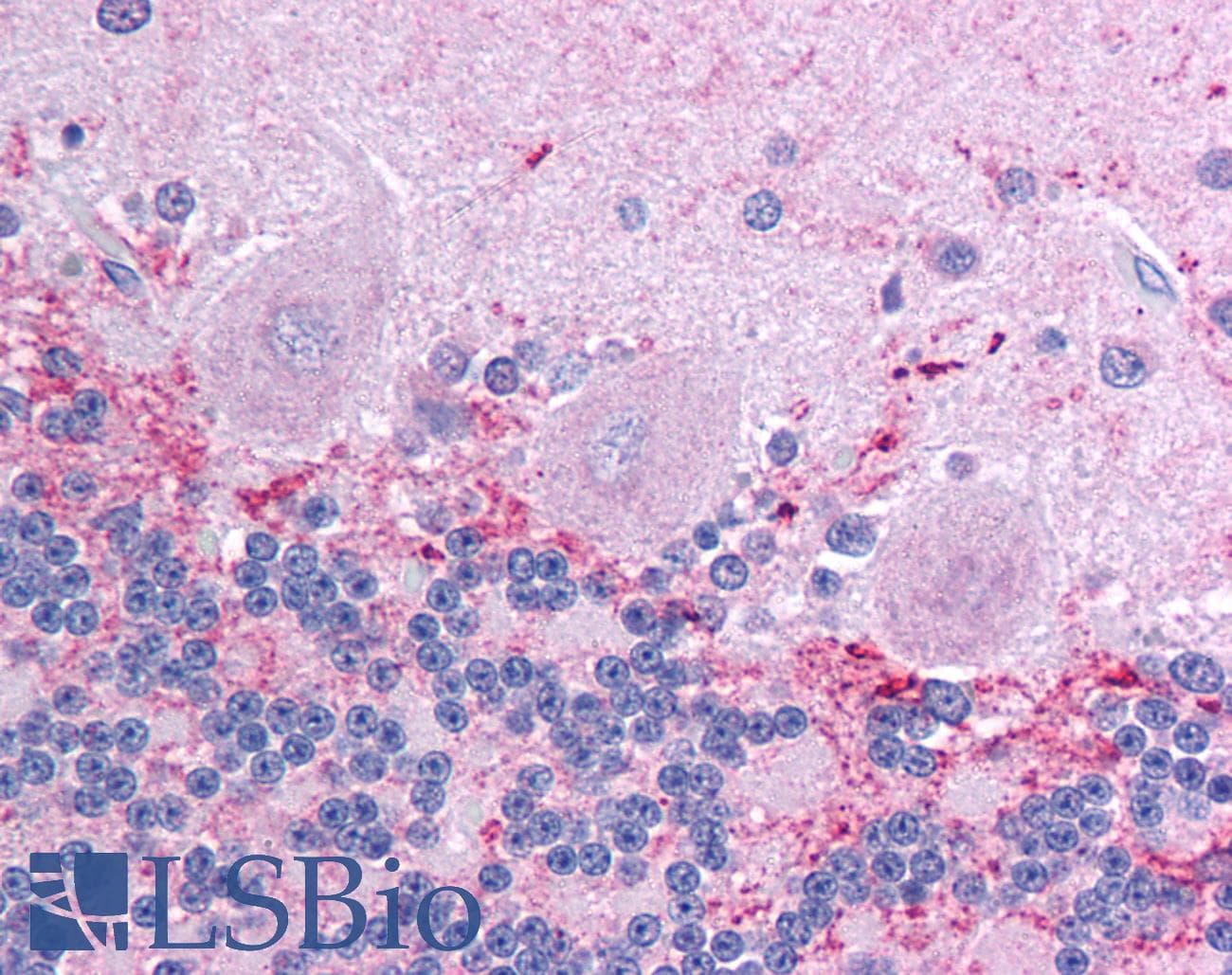 KCNIP4 / KCHIP4 Antibody (aa27-76)