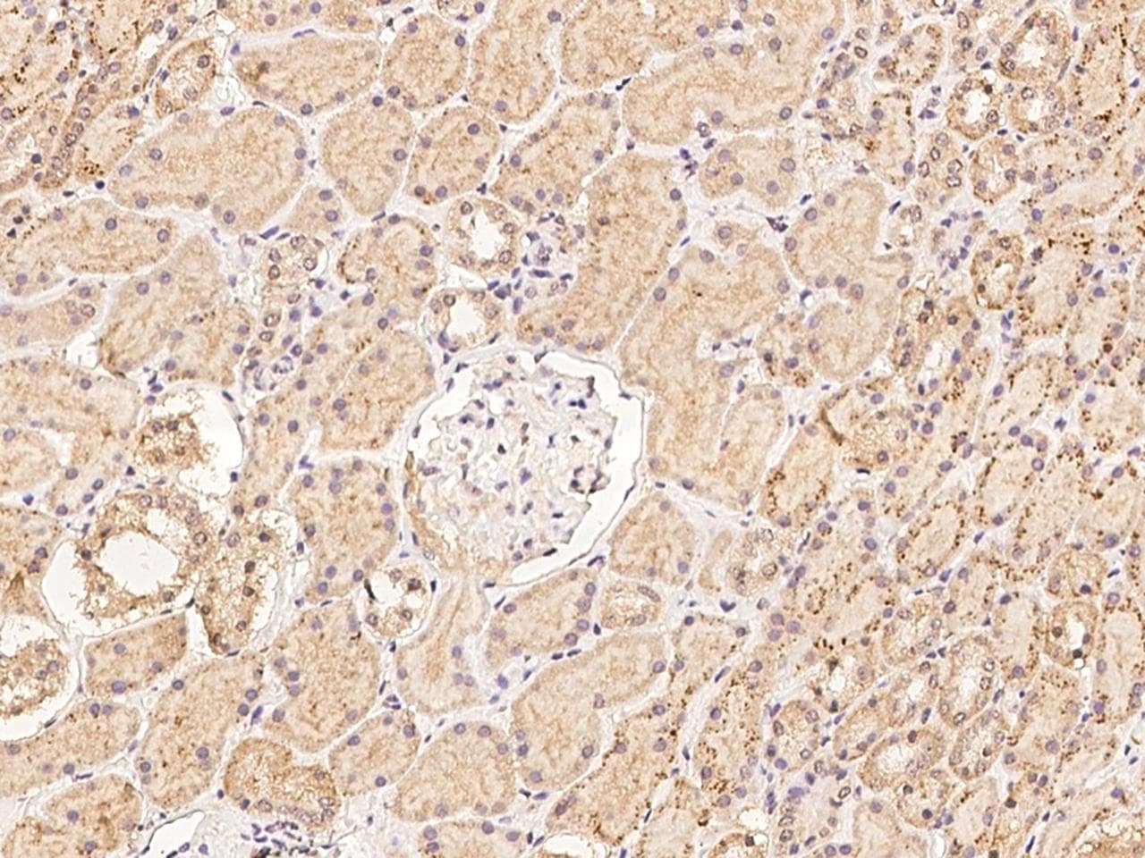 CLN6 Antibody