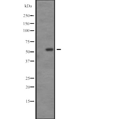 Polyclonal Rabbit anti-Human SGK3 Antibody (WB)