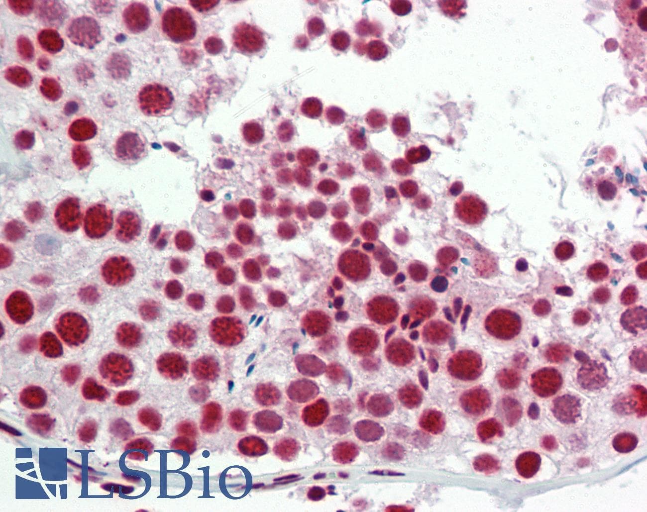 IHC-plus™ ZC3HC1 / NIPA Antibody (aa320-369)