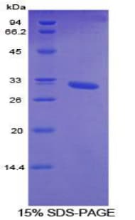 Mouse CYP26 / CYP26A1 Protein (Recombinant His-T7)