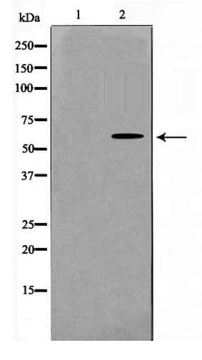 GK / Glycerol Kinase Antibody