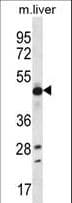 Polyclonal Rabbit anti-Human EEF1A2 Antibody (aa366-395, IHC, WB)