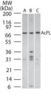 Polyclonal Rabbit anti-Human AcPL / IL18RAP Antibody (aa50-100, WB)
