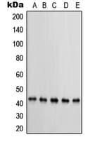 Polyclonal Rabbit anti-Human PRKAR1B Antibody (Internal, IHC, WB)