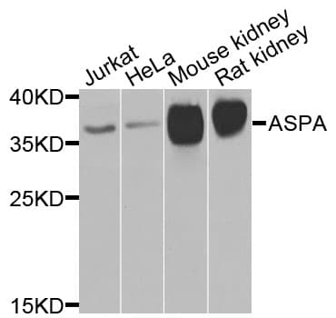 ASPA Antibody