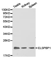 Polyclonal Rabbit anti-Human ELSPBP1 / HE12 Antibody (IHC, WB)