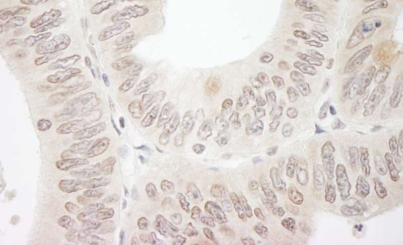 DTL / CDT2 Antibody (aa375-425)