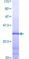 Human Vimentin Protein (Recombinant GST, N-terminus)
