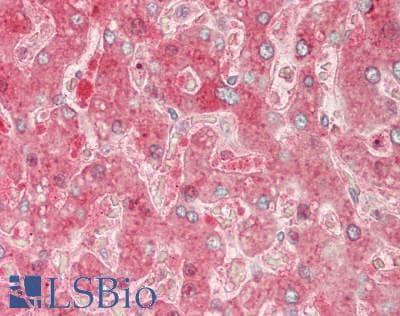 IHC-plus™ Carboxylesterase 1 / CES1 Antibody