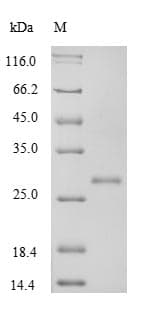 Rat TGFB1 / TGF Beta 1 Protein (Recombinant)