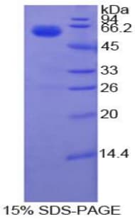 Bovine F7 / Factor VII Protein (Recombinant His-GST)