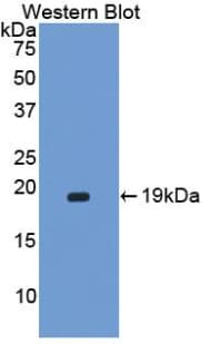 CORIN Antibody (aa448-579)