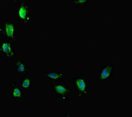 Polyclonal Rabbit anti-Human ATRX Antibody (IHC, IF)