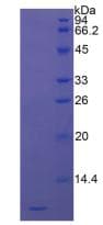 Human DEFA3 / Defensin Alpha 3 Protein (Recombinant His, N-Terminal)