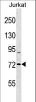 RHOBTB1 Antibody (aa623-650)