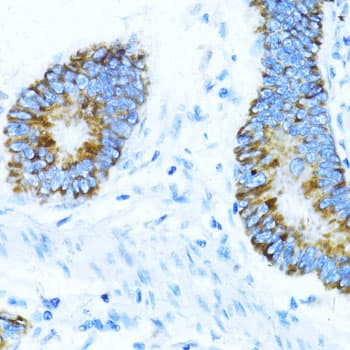 Polyclonal Rabbit anti-Human NOX1 Antibody (IHC)